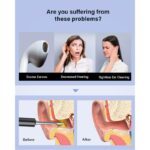 BEBIRD T5 3MP KAMERA 3.5MM LENS ŞARJLI WIFI GÖRÜNTÜLÜ KULAK TEMİZLEYİCİ SİYAH RENK - Görsel 2