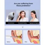 BEBIRD T5 3MP KAMERA 3.5MM LENS ŞARJLI WIFI GÖRÜNTÜLÜ KULAK TEMİZLEYİCİ BEYAZ RENK - Görsel 2