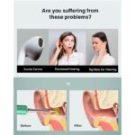 BEBIRD T5 3MP KAMERA 3.5MM LENS ŞARJLI WIFI GÖRÜNTÜLÜ KULAK TEMİZLEYİCİ YEŞİL RENK - Görsel 2